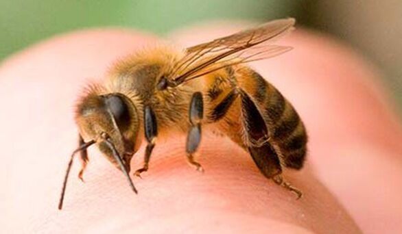 نیش زنبور - راهی شدید برای بزرگ کردن فالوس